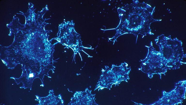 Scoperta proteina centrale nello sviluppo dei tumori