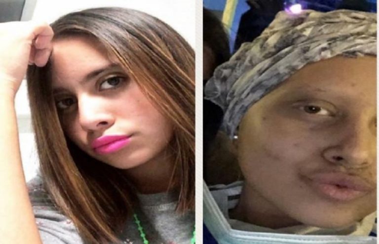 Funerali di Anna Oppolo: raccontava la leucemia nei social
