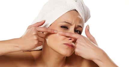6 semplici rimedi naturali per sbarazzarti dei punti neri