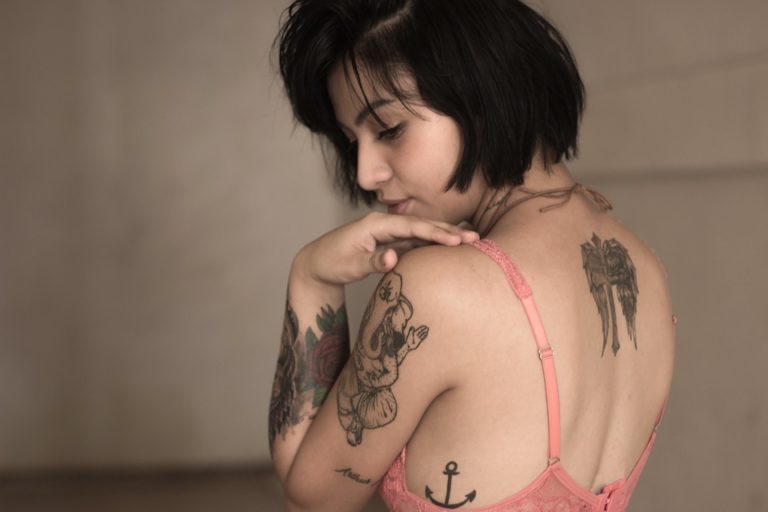 Rimozione tatuaggi con Laser Q-Switched: tutto quello che si deve sapere