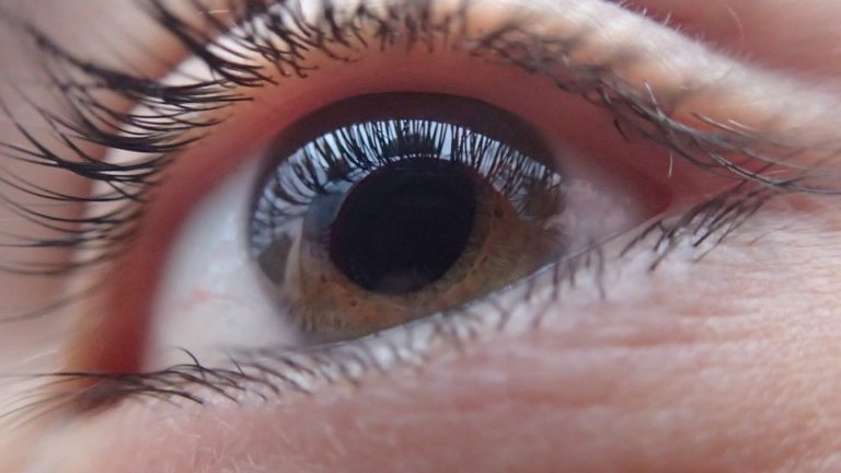glaucoma rimedi efficaci