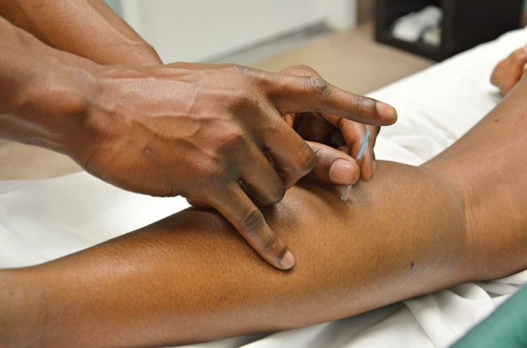 Agopuntura: il benessere a portata di … ago!