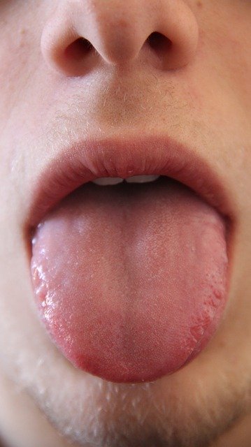 Papille gustative: quali sono le sue caratteristiche? Cosa fare quando si infiammano?