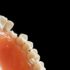 Come sostituire i denti mancanti?