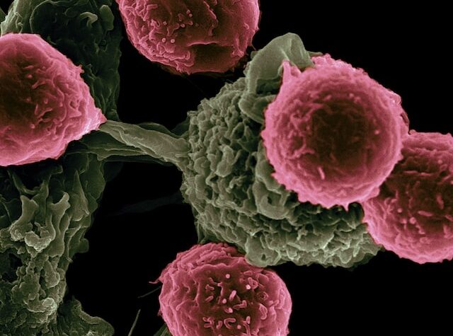 Il virus dell’herpes può aiutare davvero contro il cancro? E come?